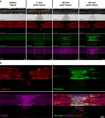 Complement inhibition can decrease the haemostatic response in a microvascular bleeding model at multiple levels